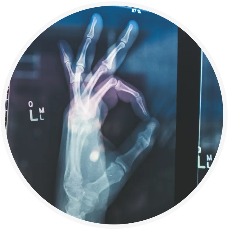 An X-ray image of a hand making an OK gesture, with the thumb and index finger forming a circle and the other three fingers extended. The bones of the hand are clearly visible.
